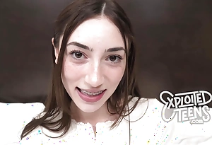 This cute 18 yr grey less braces plus freckles gives a drenched oral-service